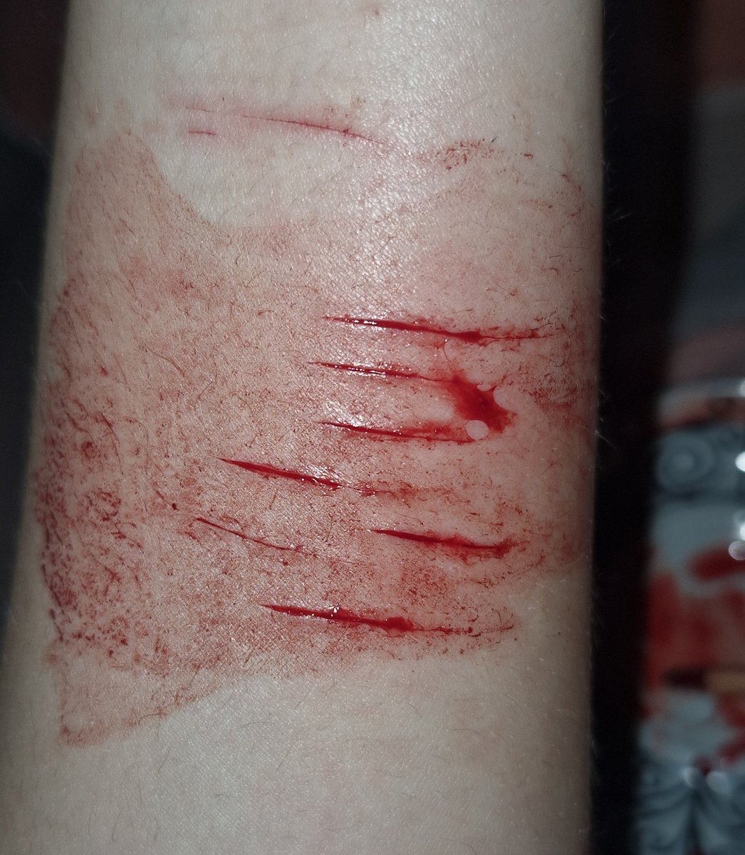 m4h001's tweet photo. perdi 17 dias limpa mas to feliz msm assim. fiz esses pra pintar pq fiquei com mtt vontade, dps posto o desenho (ignorem o braço peludo)
all fake, fake body, made with IA, sfx makeup
#shtwt #slittwt #sharm #988twt #sfxmakeup #ai https://t.co/do0U8xb6X8