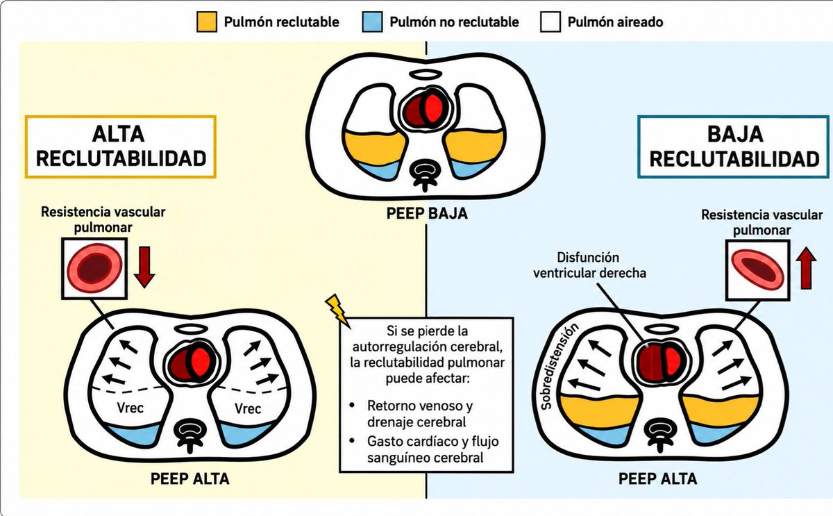 LeslieMegom's tweet photo. ▪️Fisiopatología y aplicaciones clínicas de la PEEP🫁 en la lesión cerebral aguda.🧠🤯 (LCA)
☕️Perlas cafeteras  🥯☕️
☝🏻🤓 La PEEP no está contraindicado en LCA; es herramienta útil para oxigenación si se individualiza y se vigilan PIC, PPC, PaCO₂ y hemodinámica. 
☝🏻🤓Prioriza reclutar sin sobredistender, evita hipercapnia, y protege la PAM para mantener PPC; en ARDS con baja complianza, PEEP más alto suele ser tolerable. 
▪️La tolerancia neurológica a la PEEP puede ser deficiente en pacientes con lesión cerebral. La variabilidad en la elastancia pulmonar y de la pared torácica, la capacidad de reclutamiento pulmonar, la función cardíaca , así como la integridad de la autorregulación cerebral, complican aún más las recomendaciones sobre el rango seguro de PEEP 🫁en esta población de pacientes. 
🧠🫁 El aumento del PEEP eleva la presión intratorácica; esto puede dificultar el drenaje venoso cerebral (↑ presión yugular/venosa central) y elevar la PIC, con potencial descenso del PPC = PAM − PIC. El efecto depende de la complianza pulmonar, de la PAM y del estado del CO₂. 
🧐➡️Reclutamiento vs hiperinsuflación. Cuando la PEEP recluta alvéolos y mejora el intercambio gaseoso sin hiperinsuflar, la PIC suele permanecer estable; si el PEEP provoca hiperinsuflación e hipercapnia, la PIC aumenta ⬆️por vasodilatación cerebral🧠.
🟢Rol de la complianza pulmonar. 🫁En baja complianza (SDRA), niveles más altos de PEEP🫁 transfieren menos presión al compartimento craneal y suelen tener menos impacto sobre PIC/PPC; con complianza normal, es más probable observar caída de PPC (por descenso de PAM) o cambios en flujo cerebral. 🩸🧠 La Hipercapnia e hipoxemia. La hipercapnia ( sobredistensión o RM mal tolerada) aumenta el FSC 🩸y la PIC; la hipoxemia sostenida también eleva el FSC y puede desestabilizar la autorregulación. Controlar PaCO₂/PaO₂ es tan importante como el número de PEEP. 🫁
👇🏽🤓
📜Guías/consensos de ventilación en LCA. La ventilación protectora (Vt bajos) es razonable, PEEP “moderado” individualizado es aceptable si se mantiene PPC y oxigenación. La posición prona puede considerarse en LCA con SDRA moderado-grave bajo monitorización neurohemodinámica. La calidad global de evidencia aún es limitada. 
🫁PEEP en pacientes con LCA sin lesión pulmonar grave. Estudios fisiológicos muestran que subir PEEP puede aumentar la PIC si acompaña hipercapnia, hipotensión o sobredistensión; con reclutamiento efectivo y PAM estable, la PIC suele no cambiar. ▪️
▪️PEEP en LCA + SDRA. En SDRA (baja complianza), PEEP más alto tiende a no empeorar PIC/PPC y sí mejora oxigenación; aun así, no hay evidencia de mejoría en desenlaces neurológicos por la estrategia de “PEEP alto” per se. Individualizar por mecánica y hemodinámica. 🫁🩸🧠
🤓➡️Maniobras de reclutamiento . En LCA, las RM (presiones altas y sostenidas) aumentan la PIC y reducen la PPC en promedio; si se usan, deben ser excepcionales y con monitorización continua (PIC/PPC, ecocardiografía, hemodinámica). 
💡💡CONSIDERACIONES en pacientes obesos con LCA.
🔴El incremento de PEEP se ha asociado con aumento de PIC en series pequeñas, vigilar más estrechamente. En ictus y HSA, los efectos siguen los mismos principios de presión venosa/CO₂. 
🤓☝🏻Cómo titular el PEEP en LCA (pasos prácticos)
👇🏽🧠🫁
1️⃣. Definir objetivos: SpO₂ 92–96% (o PaO₂ ~60–80 mmHg), PaCO₂ ajustada al contexto (p. ej., 35–40 mmHg salvo indicación contraria), PPC objetivo (p. ej., 60–70 mmHg protocolo local). 
2️⃣. Estimar riesgo de transmisión: revisar complianza  driving pressure y presión de meseta. Baja complianza → menor transmisión al cráneo → PEEP más “seguro”. 😃
3️⃣ Ajuste gradual: subir PEEP en pequeños incrementos (2–3 cmH₂O), vigilando PIC, PPC, PAM, PaCO₂, y mecánica (Pmeseta, driving). Si PIC sube ≥2–3 mmHg de forma sostenida o PPC cae < objetivo, retroceder. 
4️⃣. Evitar hipercapnia iatrogénica: confirmar que el cambio de PEEP no empeora PaCO₂ (sobredistensión, aumento del espacio muerto). Ajustar 👇🏽