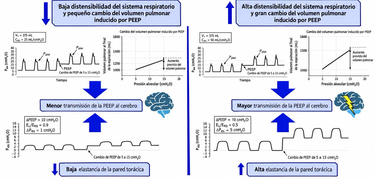 LeslieMegom's tweet photo. ▪️Fisiopatología y aplicaciones clínicas de la PEEP🫁 en la lesión cerebral aguda.🧠🤯 (LCA)
☕️Perlas cafeteras  🥯☕️
☝🏻🤓 La PEEP no está contraindicado en LCA; es herramienta útil para oxigenación si se individualiza y se vigilan PIC, PPC, PaCO₂ y hemodinámica. 
☝🏻🤓Prioriza reclutar sin sobredistender, evita hipercapnia, y protege la PAM para mantener PPC; en ARDS con baja complianza, PEEP más alto suele ser tolerable. 
▪️La tolerancia neurológica a la PEEP puede ser deficiente en pacientes con lesión cerebral. La variabilidad en la elastancia pulmonar y de la pared torácica, la capacidad de reclutamiento pulmonar, la función cardíaca , así como la integridad de la autorregulación cerebral, complican aún más las recomendaciones sobre el rango seguro de PEEP 🫁en esta población de pacientes. 
🧠🫁 El aumento del PEEP eleva la presión intratorácica; esto puede dificultar el drenaje venoso cerebral (↑ presión yugular/venosa central) y elevar la PIC, con potencial descenso del PPC = PAM − PIC. El efecto depende de la complianza pulmonar, de la PAM y del estado del CO₂. 
🧐➡️Reclutamiento vs hiperinsuflación. Cuando la PEEP recluta alvéolos y mejora el intercambio gaseoso sin hiperinsuflar, la PIC suele permanecer estable; si el PEEP provoca hiperinsuflación e hipercapnia, la PIC aumenta ⬆️por vasodilatación cerebral🧠.
🟢Rol de la complianza pulmonar. 🫁En baja complianza (SDRA), niveles más altos de PEEP🫁 transfieren menos presión al compartimento craneal y suelen tener menos impacto sobre PIC/PPC; con complianza normal, es más probable observar caída de PPC (por descenso de PAM) o cambios en flujo cerebral. 🩸🧠 La Hipercapnia e hipoxemia. La hipercapnia ( sobredistensión o RM mal tolerada) aumenta el FSC 🩸y la PIC; la hipoxemia sostenida también eleva el FSC y puede desestabilizar la autorregulación. Controlar PaCO₂/PaO₂ es tan importante como el número de PEEP. 🫁
👇🏽🤓
📜Guías/consensos de ventilación en LCA. La ventilación protectora (Vt bajos) es razonable, PEEP “moderado” individualizado es aceptable si se mantiene PPC y oxigenación. La posición prona puede considerarse en LCA con SDRA moderado-grave bajo monitorización neurohemodinámica. La calidad global de evidencia aún es limitada. 
🫁PEEP en pacientes con LCA sin lesión pulmonar grave. Estudios fisiológicos muestran que subir PEEP puede aumentar la PIC si acompaña hipercapnia, hipotensión o sobredistensión; con reclutamiento efectivo y PAM estable, la PIC suele no cambiar. ▪️
▪️PEEP en LCA + SDRA. En SDRA (baja complianza), PEEP más alto tiende a no empeorar PIC/PPC y sí mejora oxigenación; aun así, no hay evidencia de mejoría en desenlaces neurológicos por la estrategia de “PEEP alto” per se. Individualizar por mecánica y hemodinámica. 🫁🩸🧠
🤓➡️Maniobras de reclutamiento . En LCA, las RM (presiones altas y sostenidas) aumentan la PIC y reducen la PPC en promedio; si se usan, deben ser excepcionales y con monitorización continua (PIC/PPC, ecocardiografía, hemodinámica). 
💡💡CONSIDERACIONES en pacientes obesos con LCA.
🔴El incremento de PEEP se ha asociado con aumento de PIC en series pequeñas, vigilar más estrechamente. En ictus y HSA, los efectos siguen los mismos principios de presión venosa/CO₂. 
🤓☝🏻Cómo titular el PEEP en LCA (pasos prácticos)
👇🏽🧠🫁
1️⃣. Definir objetivos: SpO₂ 92–96% (o PaO₂ ~60–80 mmHg), PaCO₂ ajustada al contexto (p. ej., 35–40 mmHg salvo indicación contraria), PPC objetivo (p. ej., 60–70 mmHg protocolo local). 
2️⃣. Estimar riesgo de transmisión: revisar complianza  driving pressure y presión de meseta. Baja complianza → menor transmisión al cráneo → PEEP más “seguro”. 😃
3️⃣ Ajuste gradual: subir PEEP en pequeños incrementos (2–3 cmH₂O), vigilando PIC, PPC, PAM, PaCO₂, y mecánica (Pmeseta, driving). Si PIC sube ≥2–3 mmHg de forma sostenida o PPC cae < objetivo, retroceder. 
4️⃣. Evitar hipercapnia iatrogénica: confirmar que el cambio de PEEP no empeora PaCO₂ (sobredistensión, aumento del espacio muerto). Ajustar 👇🏽