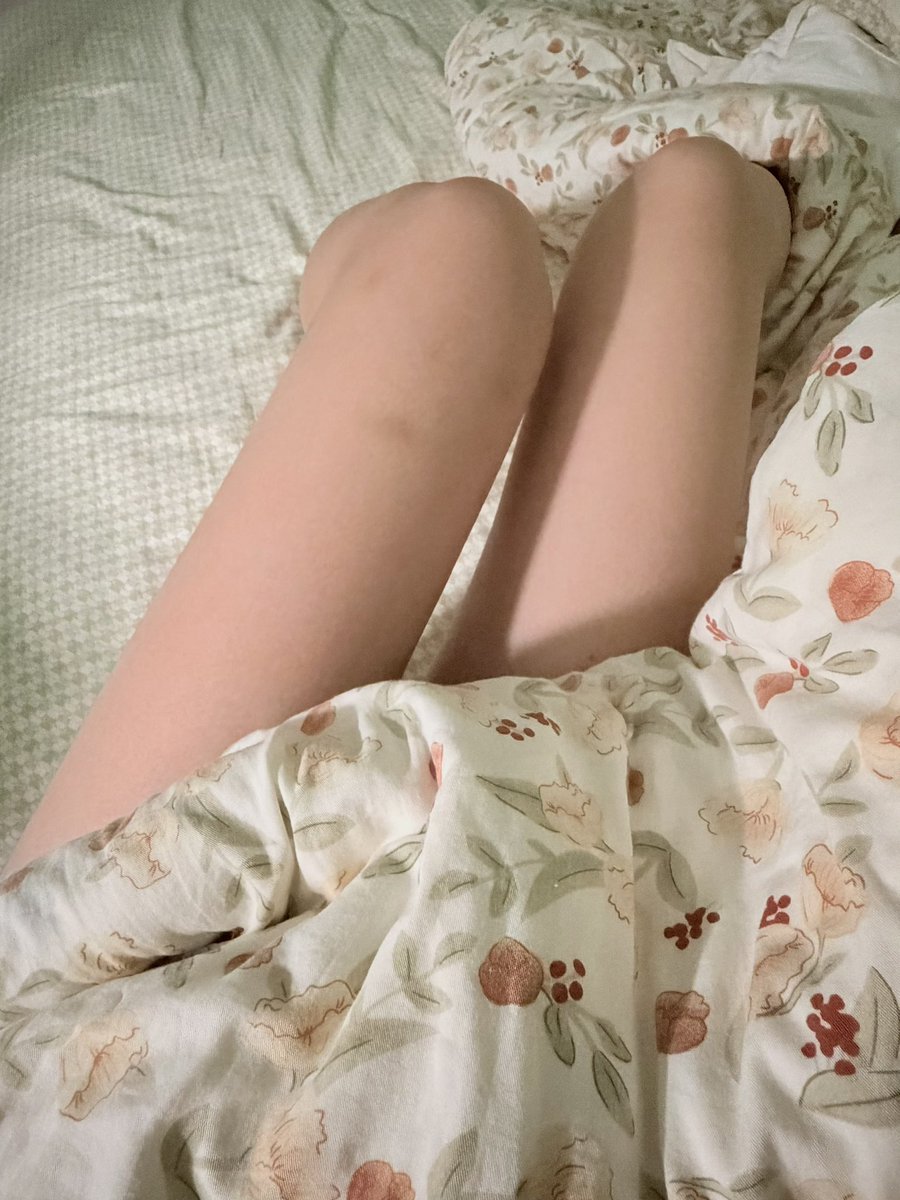 uable0's tweet photo. 腿碰一下就会青一块是为什么啊。 https://t.co/pIZT93B5nG
