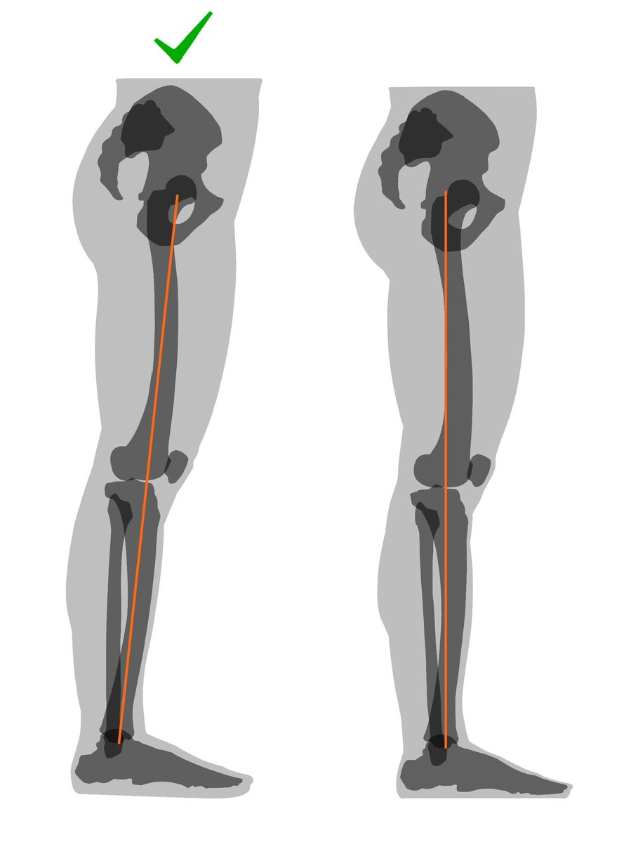 kato_anatomy's tweet photo. まっすぐ立った時の脚の軸 https://t.co/ohMn3JrC8R