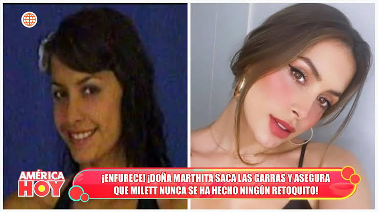 Hughesvnp's tweet photo. @Karmavibes02 @frxanciscxo @blessedbyinti En todos los países hay operadas y Perú no escapa de eso también se maquillan más que las argentinas en promedio https://t.co/fqIQtdXbUk