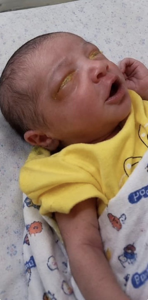 Uncle_kkla's tweet photo. I have spent the last 3 days searching for a way to sponsor the treatment, but sadly I couldn’t get it 🥹💔

I don’t have any kobo to save my son’s life, please help save him

Account details

1680652242
Suwaiba Muhammad 
Access Bank

May God bless u as u help🙏🏽🥹 https://t.co/iICaGcg846