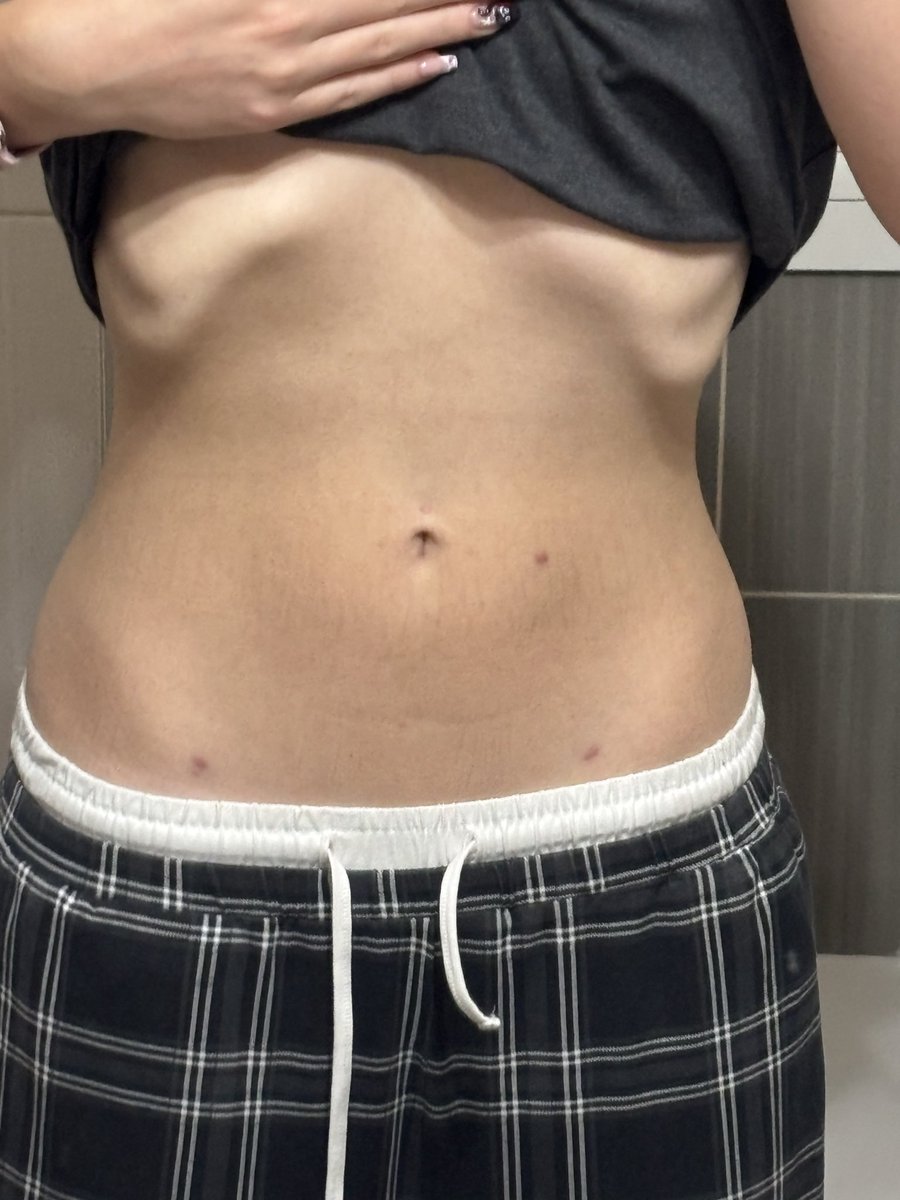 Julia1irp's tweet photo. why are my ribs flare and uneven #weird #edrtwtㅤ #bodycheck https://t.co/GrvMuOuB4g