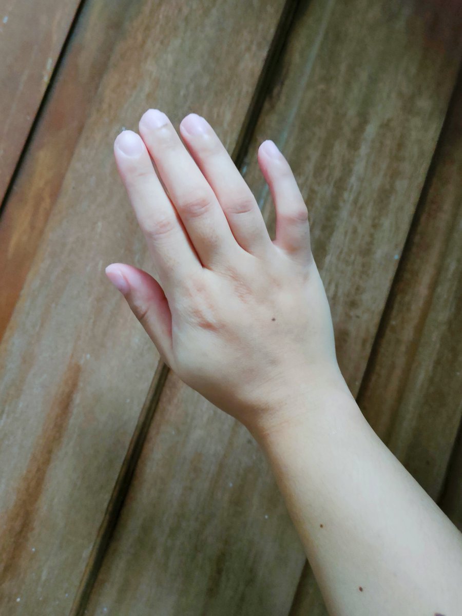 vhenyfirevt's tweet photo. No more battle nails 🥺

Removed it myself coz the nail tech won't reply to me, nails are also getting too soft to stay for another week so https://t.co/mK9J6b7Iuj