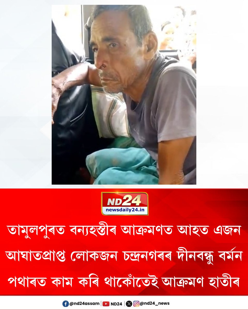 nd24_news's tweet photo. তামুলপুৰত বন্যহস্তীৰ আ*ক্ৰ*মণত আহত এজন। পথাৰত কাম কৰি থাকোঁতেই আ*ক্ৰ*মণ হাতীৰ। আঘাতপ্ৰাপ্ত লোকজন চন্দ্ৰনগৰৰ দীনবন্ধু বৰ্মন। হাতীৰ আ*ক্ৰ*মণৰ পৰা কথমপি ৰক্ষা আন দুজন চকীদাৰৰ। চিকিৎসাৰ বাবে কুমাৰীকাটা ৰাজ্যিক চিকিৎসালয়ত ভৰ্তি লোকজনক।
#ElephantAttack #AssamNews https://t.co/eNN7xZ3Kag