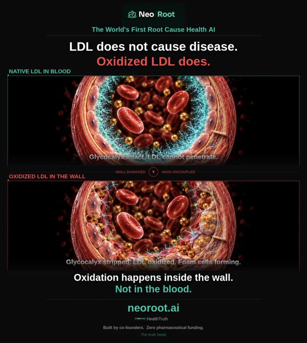 markkaplan20's tweet photo. I want you to think about white blood cells differently.

When you hear "plaque," most people picture cholesterol clogging a pipe. That is not what happens.

Here is what actually happens:

When your artery wall is damaged, LDL particles slip through and become oxidized. Your immune system detects the threat. It sends white blood cells. Monocytes cross into the wall and become macrophages. They do exactly what they are supposed to do. They engulf the oxidized LDL to clean it up.

But they cannot break it down. They swell. They become foam cells. And foam cells are the plaque.

Read that again. The immune response that is trying to save you is building the disease.

Blaming white blood cells for plaque is like blaming firefighters for fires. They are at the scene because there is a fire. The more firefighters you see, the bigger the fire. But the firefighters did not start it.

The fire is the damaged wall. Insulin resistance. Chronic inflammation. Uncoupled eNOS. A stripped glycocalyx. That is what let the LDL in. That is what oxidized it. That is what called the immune system.

Nobody asks why the fire started. They just count the trucks.

That is modern cardiology. Count the particles. Ignore the wall.

The truth heals