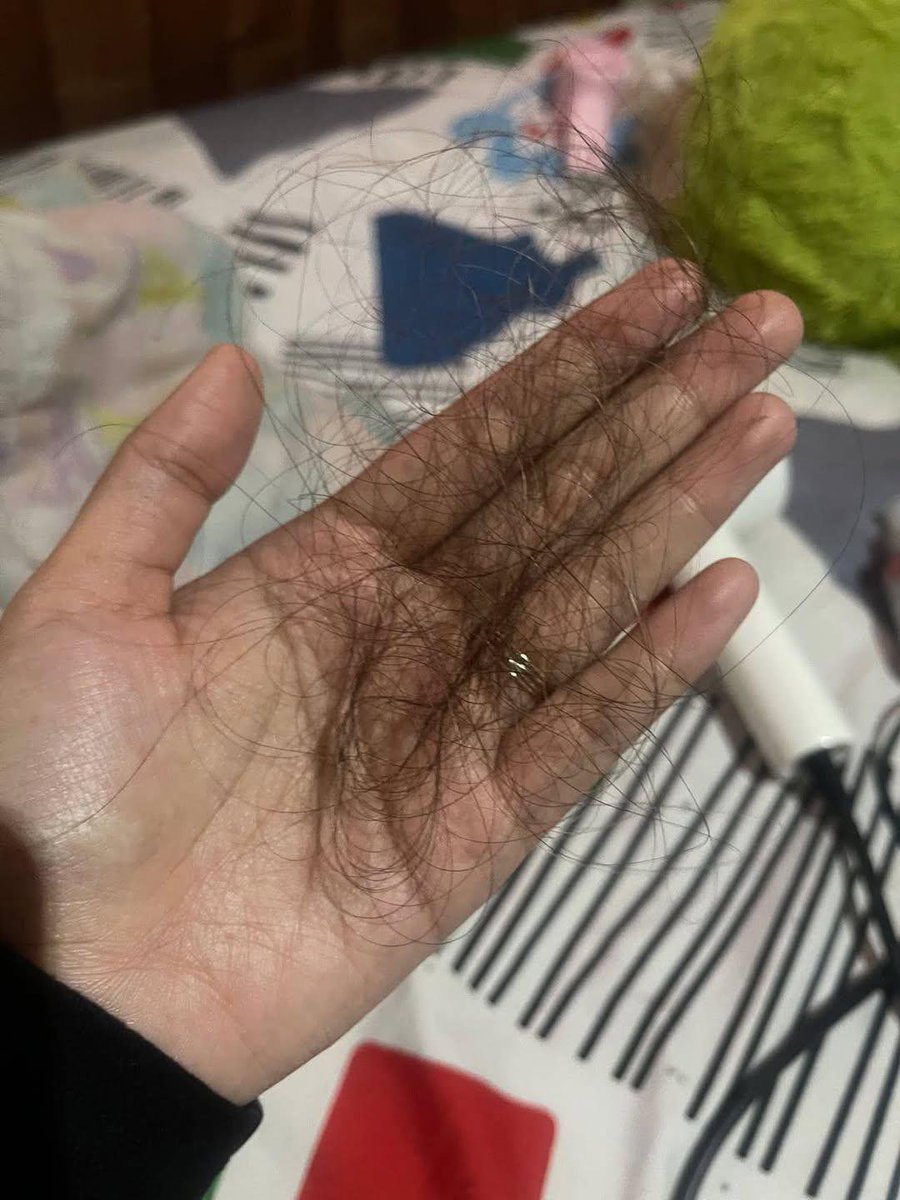 ftriee26's tweet photo. apa gue kataaa GACORRR BGT GA
bertahun tahun ngabisin duit ada kali jutaan buat rambut rontok.. tp giliran iseng coba yg murah malah bisa rambut ni balik sehat lagi🥲 https://t.co/Q0XHqjcwHQ