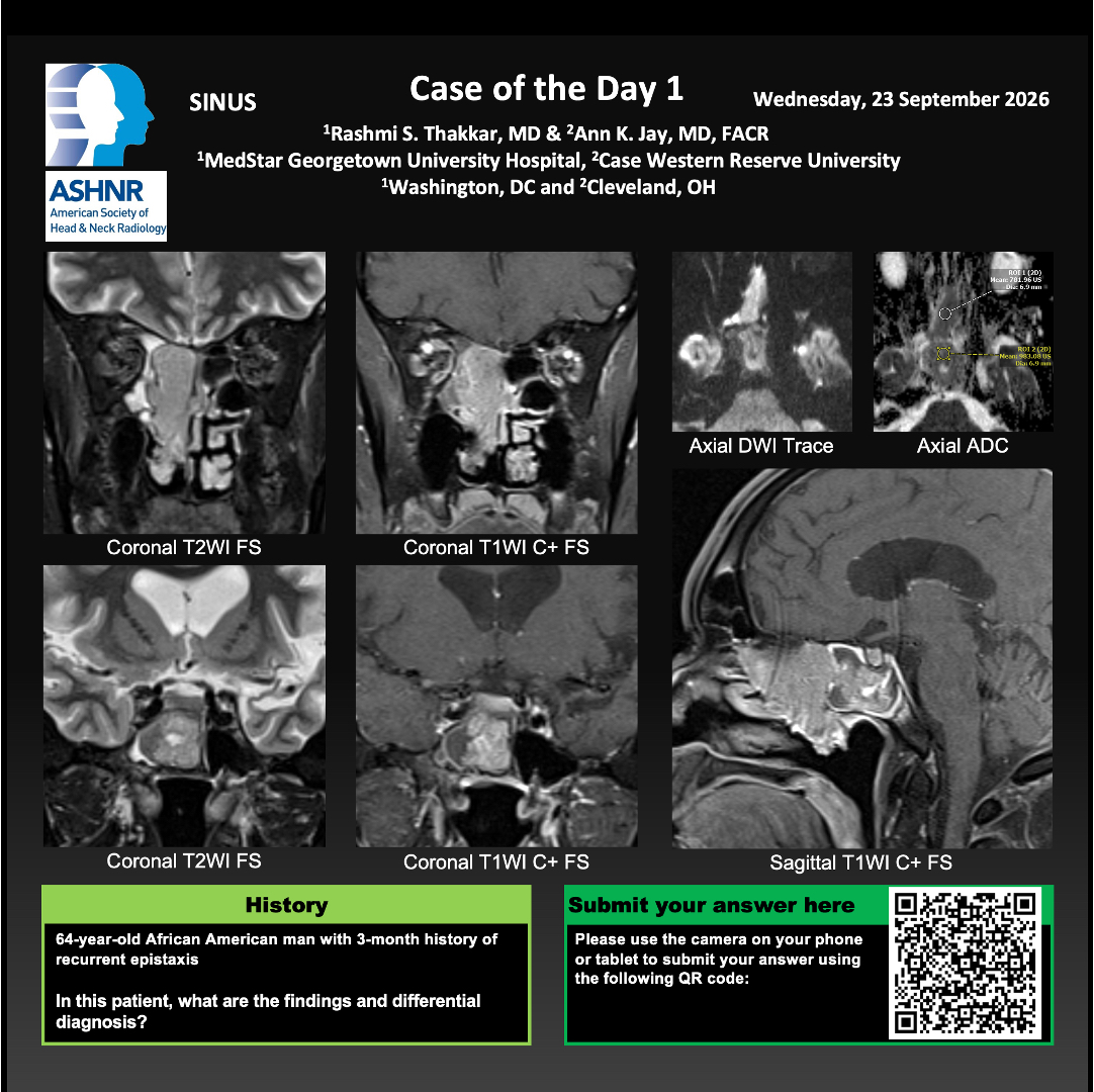 ASHNRSociety's tweet photo. Thanks to our #ASHNR26 Case of the Day Day 1 presenters for the fantastic cases! https://t.co/82BW2Bg4EO