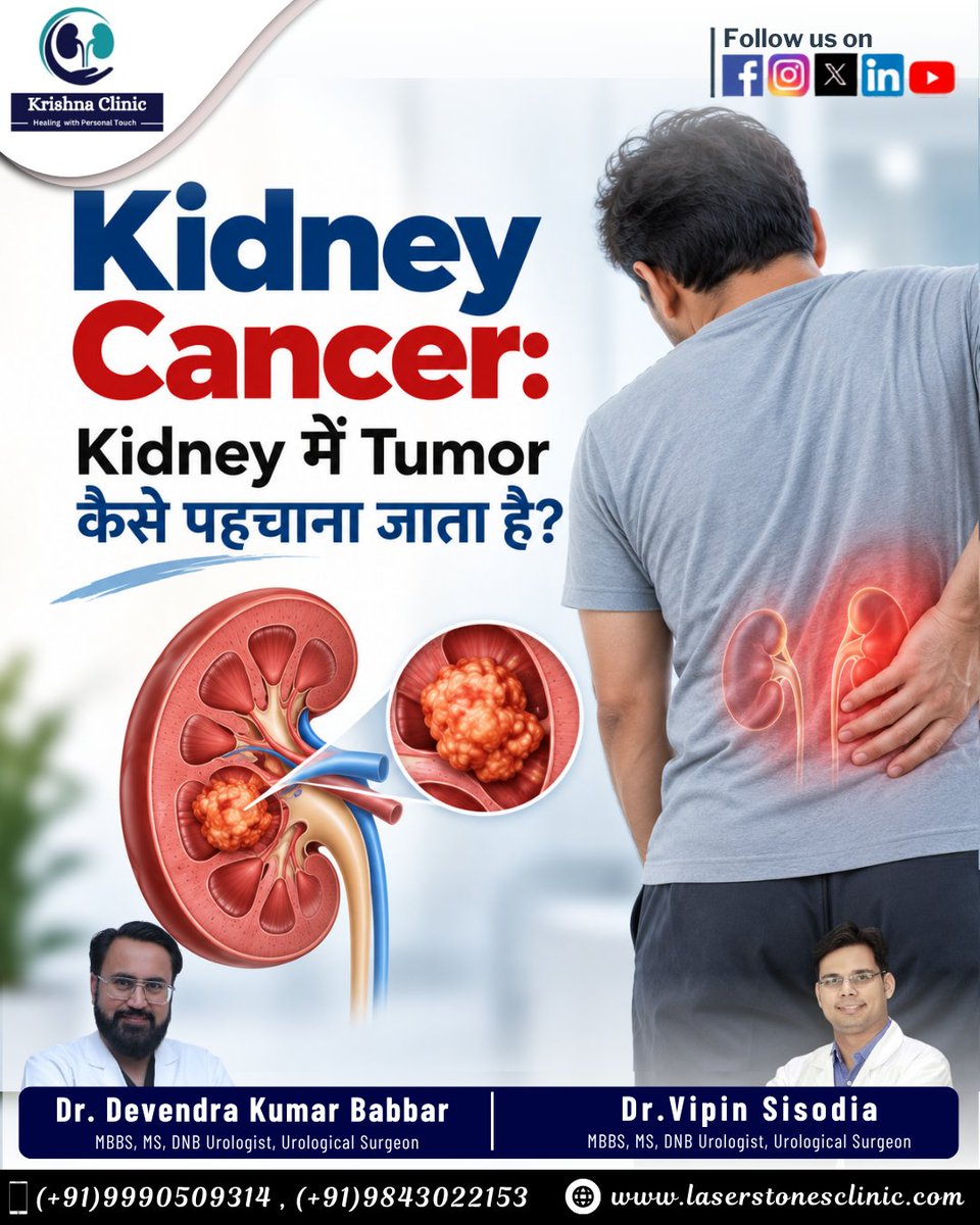 LaserStones's tweet photo. Kidney Cancer: Kidney Mein Tumor Kaise Pehchana Jata Hai?

Expert Urological Care

Dr. Devendra Kumar Babbar
Dr. Vipin Sisodia

Appointments:
+91 9990509314 | +91 9843022153
🌐 https://t.co/A4lIegiRix
-
#KidneyCancer #KidneyTumor #KidneyHealth #KidneyCancerAwareness #Urology https://t.co/zShl6XzcZn