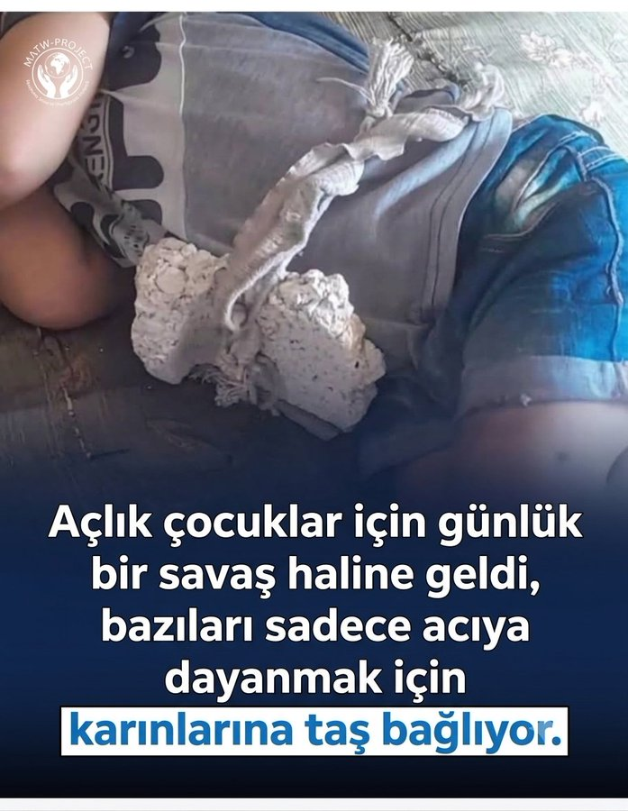 Ferdi_Karabasan's tweet photo. Gazze'de Açlıktan Etkilenen Çocuk

Sünnet-i Nebevi (s.a.v.) Hatırası Yeniden Canlandı https://t.co/BhS5syEUeB