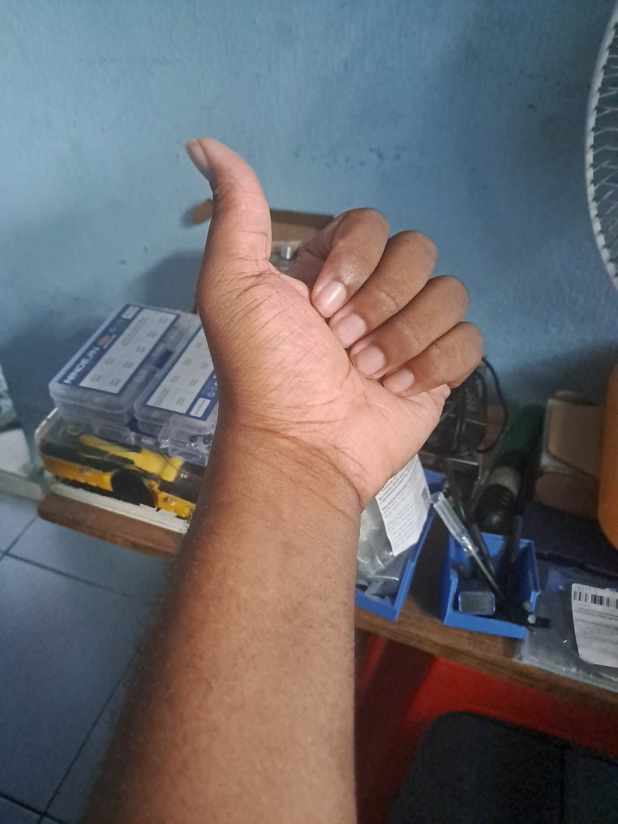 AlchemyMRzfju's tweet photo. Dude what are you on.  

So now I gotta show that I'm black 🤣🤣

Lmfao I'm in Nigeria born and bred here 😭😂😂 https://t.co/GT64nOHJSf