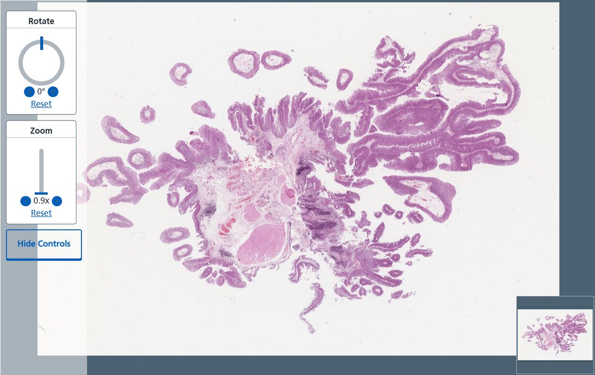 RCPath's tweet photo. Ready to put your diagnostic skills to the test?
Explore a variety of Whole Slide Image urology cases across Levels 1-5 on the #PathologyPortal: https://t.co/q3WsOEDCKQ
If you haven't joined yet, sign up to the Pathology Portal today: https://t.co/7GOSaqBl9G https://t.co/q0BFJbxsop