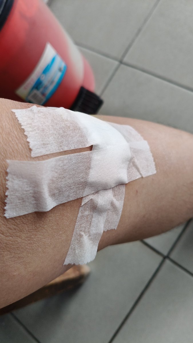 des_desdes_'s tweet photo. Fell down on the road.... Sucks that this happened before I'm going to Singapore 🥺 https://t.co/52VGrzYYKx