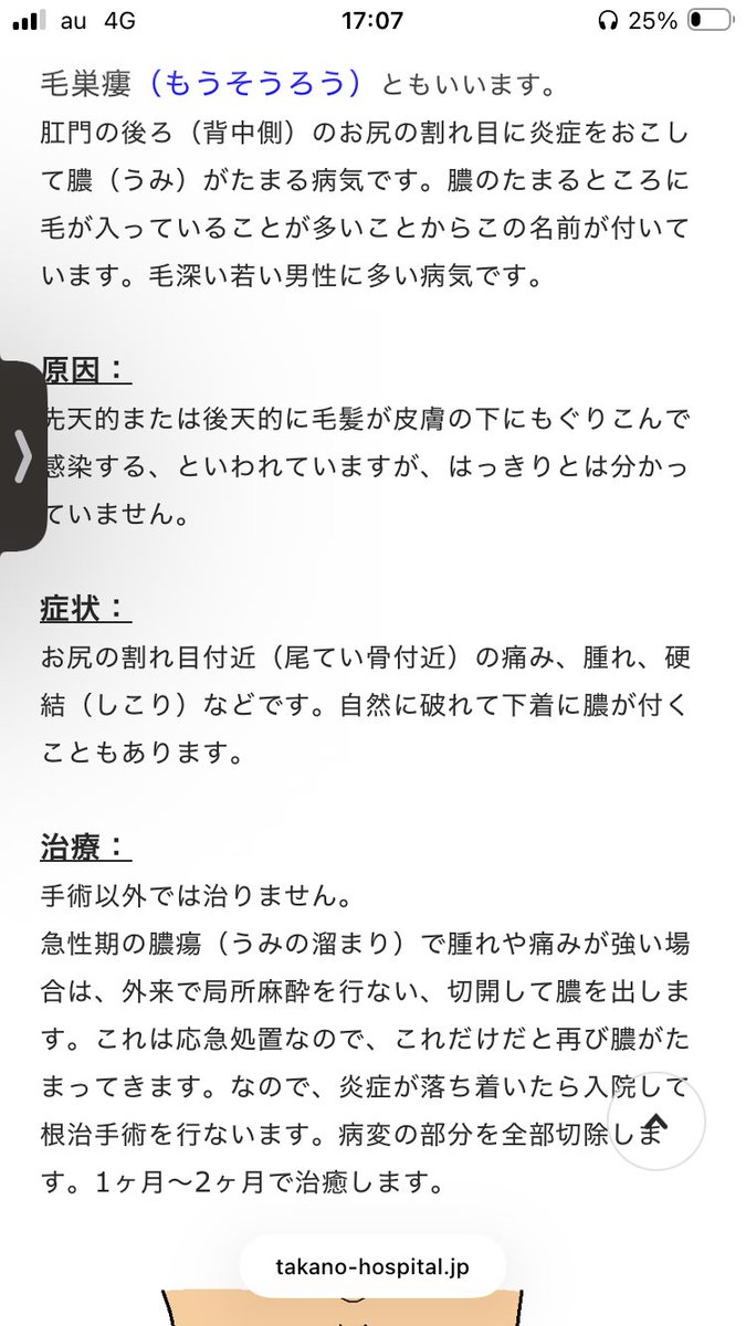 terapachi1's tweet photo. ケツ痛い理由これっぽい
勘弁してほしい https://t.co/AkwkUbo259