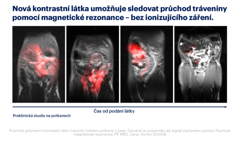 EARA_CZ's tweet photo. Vědci z @IOCBPrague vyvinuli novou látku na bázi fluoru, která umožňuje pomocí #magnetické rezonance sledovat, jak rychle #potrava prochází trávicím traktem. Metoda byla zatím úspěšně ověřena na potkanech🐀🐀🐀
👉https://t.co/BhUTfaFWs8
#EARA #AnimalResearch #PokusyNaZvířatech https://t.co/ZJ8fdLNlqr