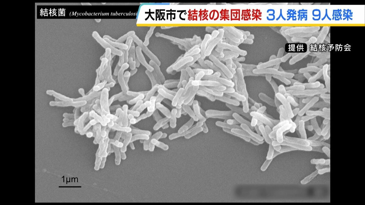 livedoornews's tweet photo. 【診断】大阪市内で「結核」集団感染 日本語教育機関の関係者ら12人が感染・発病
https://t.co/FgMn0y7nls

日本語教育機関の関係者である20代の女性が結核と診断され、関係者らを対象に調査したところ、発病者2人と、まだ症状が出ていない感染者9人を確認したという。 https://t.co/ZVmbXoAAih