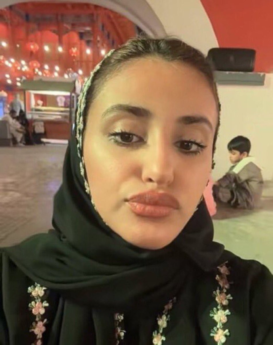 Qzzz0Q's tweet photo. مكس شفايف يعطب مخك يا غبي 😵‍💫🐽 https://t.co/ZicUJAbr9B