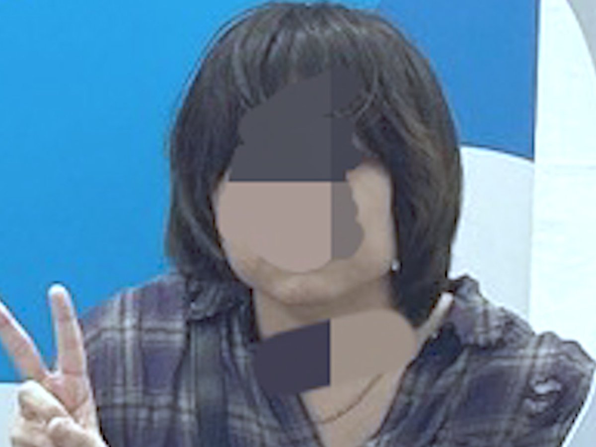ABJXE's tweet photo. 左︰1年前
右︰現在

整形ってすげえな https://t.co/04UuhnwYga