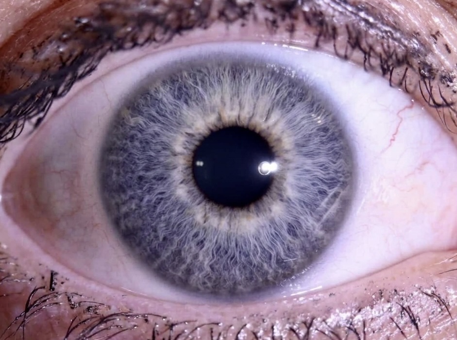 ClaudioGuipt5f's tweet photo. In iridology, “neurolymphatic” refers to the relationship between the nervous and lymphatic systems. Imbalances may relate to stress sensitivity, sluggish lymph flow, inflammation, fatigue, and more. Supporting both starts with hydration, movement, https://t.co/ocCSBeAHPJ
