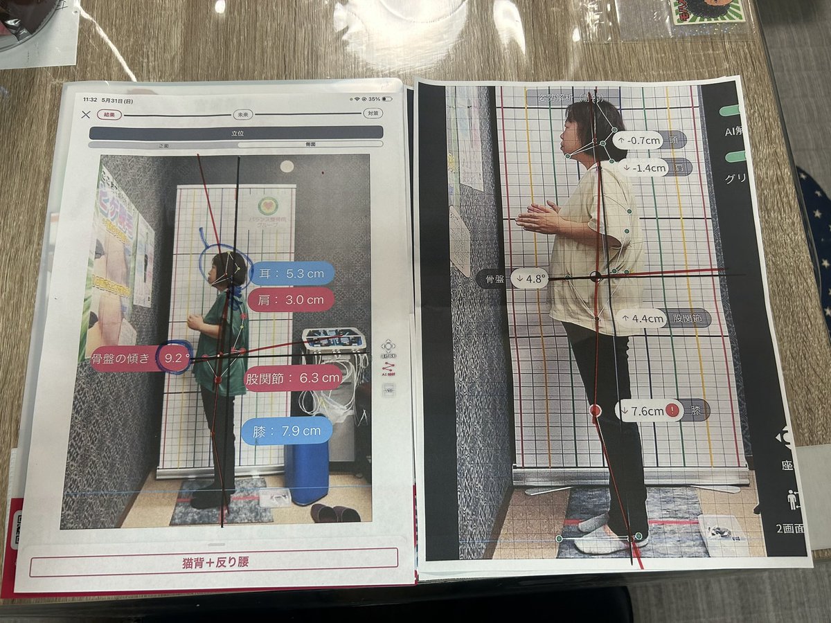 tym0816's tweet photo. 整体に通いはじめて4ヶ月。
もみほぐし2ヶ月➕インナーマッスルトレーニング2ヶ月　週1回でここまで来たなら良しとしよう！ https://t.co/Xc9LOalL9b