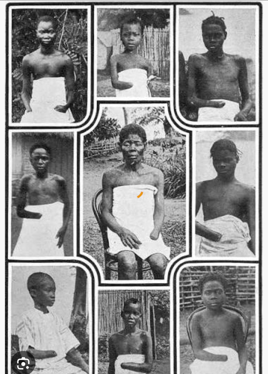 Asaagajr's tweet photo. THE CONGO ATROCITIES WHEN HUMAN LIFE BECAME A RESOURCE.

Before the world spoke about human rights, millions of Congolese people lived through a nightmare created by the demand for one thing: rubber.

Men were forced into the forests to collect rubber for export.

Villages that failed to meet impossible quotas could be punished.

Families were threatened.
People were separated from their loved ones.

And the wealth extracted from the Congo helped enrich a system thousands of miles away while the people producing it suffered.

The most painful part wasn't just the violence.

It was the idea that a human being could be treated as less valuable than the product they were forced to produce.

Rubber left the Congo.

Fortunes were made.

But countless Congolese lives were permanently changed.

And history still carries the question:

How does an entire world watch human suffering happen on such a massive scale before finally saying, "Enough"?
