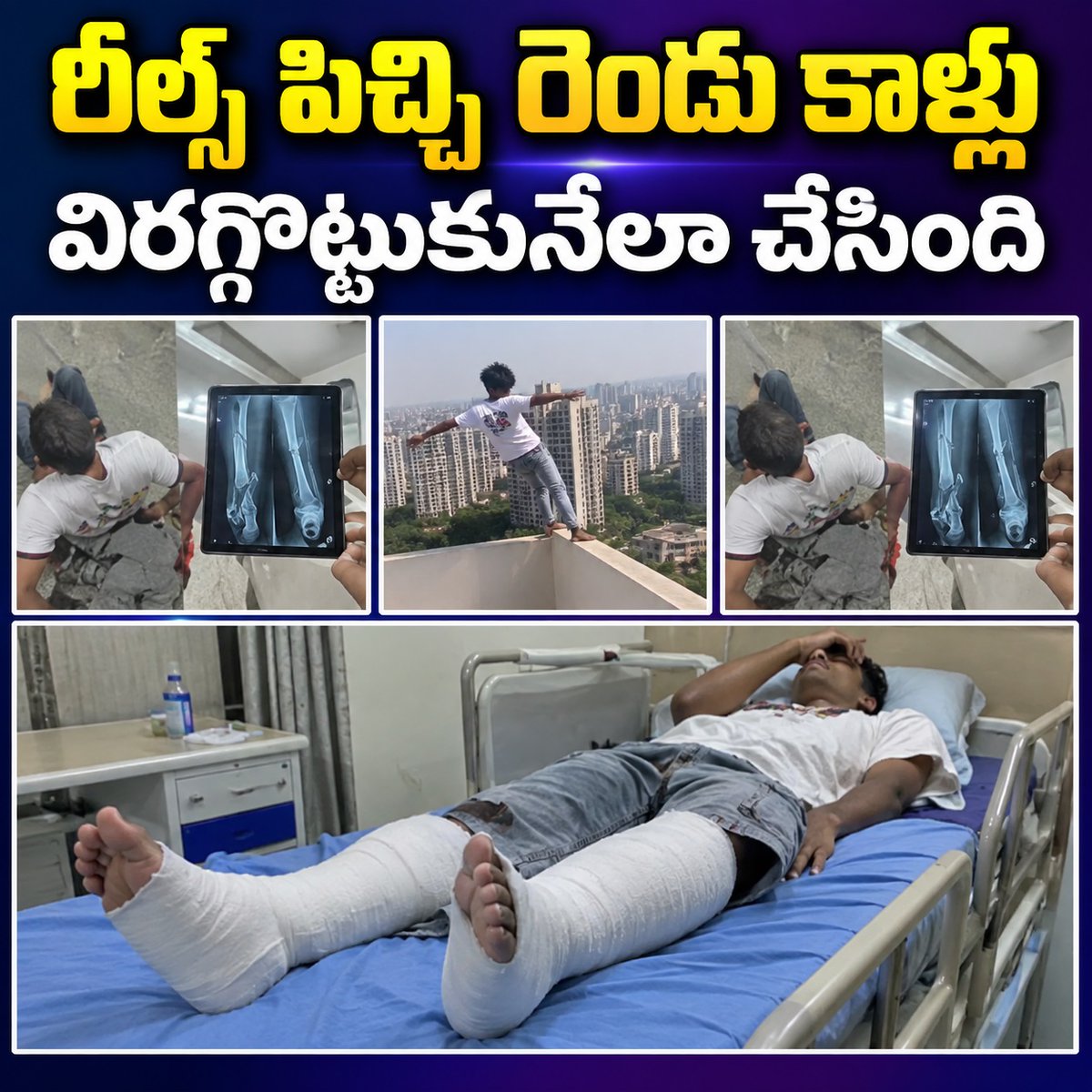 TariNolfeq1's tweet photo. రీల్స్ పిచ్చి, లైకుల వేట ఓ యువకుడిని ఆసుపత్రి పాలు చేసింది. ఝాన్సీలోని పహుజ్ డ్యామ్ వద్ద 30 అడుగుల ఎత్తు నుంచి దూకి వీడియో తీయించుకోగా, నీటిలోని రాళ్లపై పడి రెండు కాళ్లు విరిగాయి. https://t.co/CuoFOGh7H9