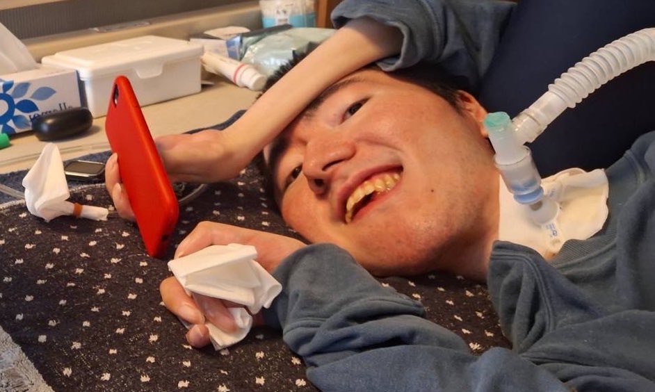 meriodasu_3618's tweet photo. 病気を金を稼ぐ道具にするな
ってたまに言われるけど

いいや。します。

障害は僕にとって邪魔なものでしかない。
でもその邪魔なものをどう使うかは僕の自由。

僕の人生の邪魔してるんだから
せめて生きる上で使わせろよ？この身体の家賃代払え！って思ってるので今後もこいつをこき使います！ https://t.co/w30dZhNwcU