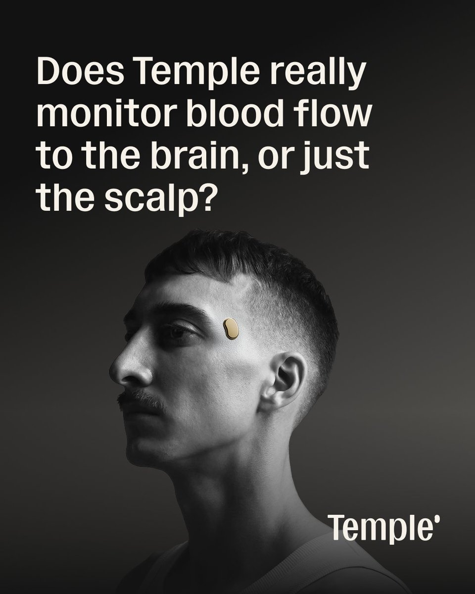 deepigoyal's tweet photo. Does @temple really monitor blood flow to the brain, or just the scalp?

In our second validation study, we tested Temple BrainFlow against time-domain NIRS, one of the few technologies that can separate brain blood volume changes from scalp blood volume changes. We had 60 participants go through three physiological challenges: head-down tilt, stand-to-squat, stand-to-supine.

Across all three challenges, Temple BrainFlow tracked brain blood volume at r=0.84-0.91, significantly more than scalp blood volume. The most significant result came from head-down tilt, where Temple's correlation with the brain was 0.91, and scalp correlation was just 0.49.

Key takeaway: Temple tracks the brain, much more than the scalp.

Why this matters: Cerebral Blood Flow responds to almost everything longevity-oriented people already do. It rises with aerobic exercise, and VO2max correlates directly with it. It rises with cold exposure. It rises with meditation. Better sleep sustains it. It drops when you sit for too long. It drops when you are dehydrated. It is one of the most responsive and integrative biomarkers of how well your body is actually running, and aging.

Until now, you could only measure it in a clinical setting, in a single snapshot. Temple measures it continuously, in real time, while you live your life. And Temple is, as of today, the only wearable in the world with validations against brain blood volume, and not just scalp.

This study was guided by our Scientific Advisor, Prof. David Boas, Director of Boston University's Neurophotonics Center, and the mind behind several new, high-impact, biomedical optical technologies in neuroscience, including NIRS.

This is the second modality Temple BrainFlow is now validated against, after Transcranial Doppler. More coming soon.

Link: 
https://t.co/zETs9gn5Cg

The paper is posted as a preprint and submitted for peer review. We encourage researchers to replicate this. We'll happily loan Temples to any qualified researcher who wants to pressure-test any of our metrics independently.

Cc @agingroy