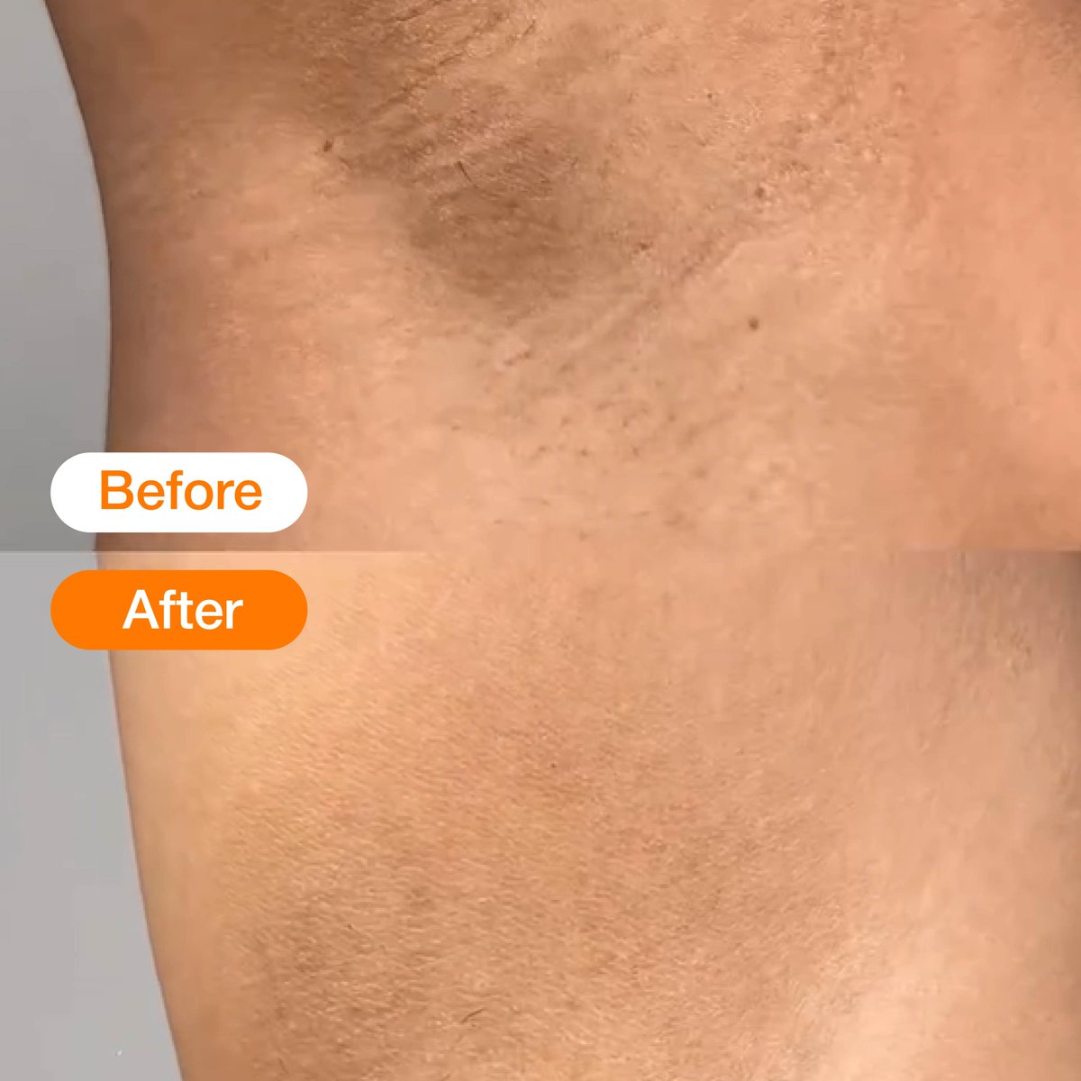 SalsaCosmetic's tweet photo. COMBO PRODUK BUAT KETI CARE-MU~😳

Dari keti yang awalnya gelap jadi lebih cerahan, kalau rutin pakai combo ini 😆

Cuss intip rutinitasnya👇 (a thread)

#salsacosmetic #beautyiseasy https://t.co/ATIs5riH45