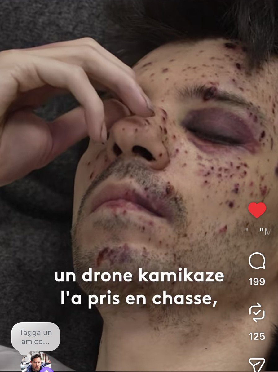 ilario82's tweet photo. «Ho detto: “Mamma, ti voglio bene”. E lei mi ha risposto: “Anche io ti voglio bene”». Maksim, di Kramatorsk, ha salutato sua madre mentre il drone fpv si avvicinava. Lei è rimasta uccisa.  Lo #humansafari russo è terrorismo. Servizio @le20hfrancetele https://t.co/CwqMYPkALZ