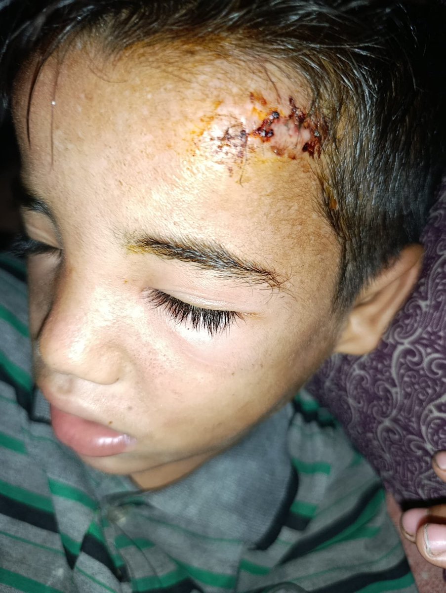 1wftk's tweet photo. أيُّ قومٍ اليوم أحقُّ بالبُشرى من أهل غزة؟ 💔
هؤلاء الذين عبروا نارًا تتلوّى لها الجبال…
مرّوا بالقتل والجوع والعطش والقهر، ذاقوا الخذلان، وتكالب عليهم القريب والبعيد.
ومع ذلك #لا نجد من يغيثنا 🙏💔🍉👇
https://t.co/z3frCdHBlf https://t.co/0p1mzw4wYR