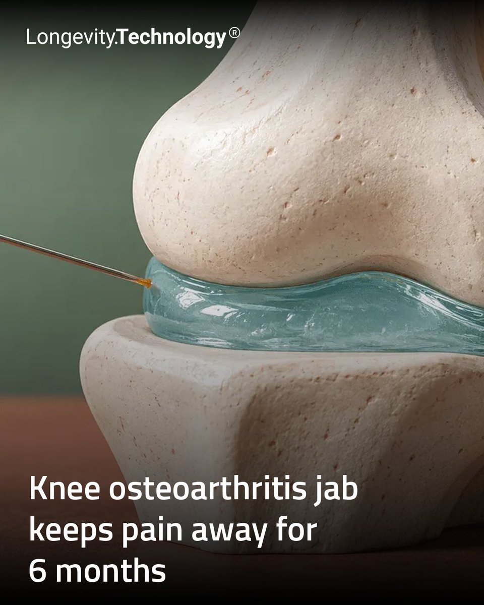 LongevityTech's tweet photo. Belgian clinical data show Allegro’s nanotech injection Hydrocelin delivers lasting knee osteoarthritis relief from a single shot.
https://t.co/ZYRYgQfrRf
#longevity #geroscience #osteoarthritis #nanotech #Hydrocelin https://t.co/7X7Lmd9EC9