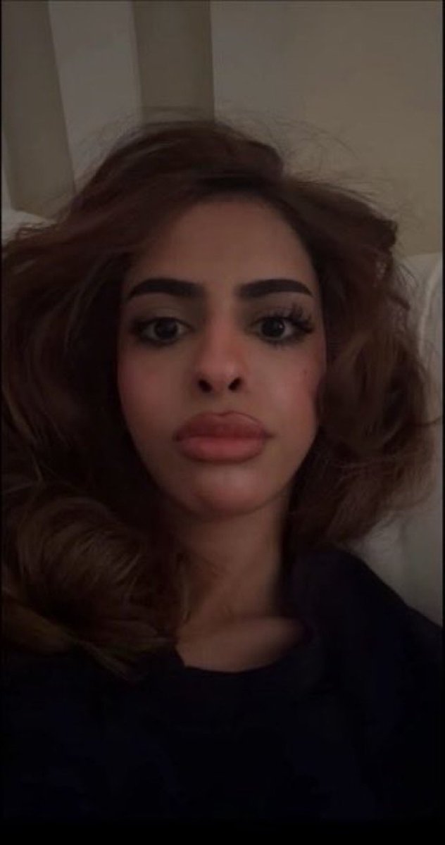 Qzzz0Q's tweet photo. شفايفها تلسع شحمتك يا مهان تفووووو 😵‍💫😵‍💫 https://t.co/hl4CM8f9jv