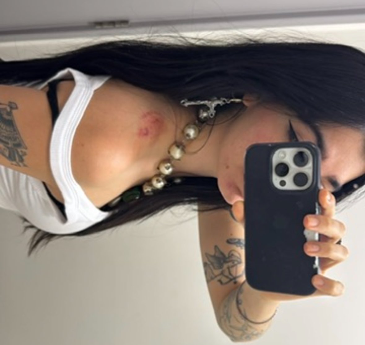 banidacarla's tweet photo. lembrando aqui quando um mendigo foi tentar me assaltar, saímos no soco, ele me MORDEU, não conseguiu roubar nada, e no meio da luta corporal consegui ROUBAR a mochila dele desgraçado https://t.co/8bgEy2oKMJ