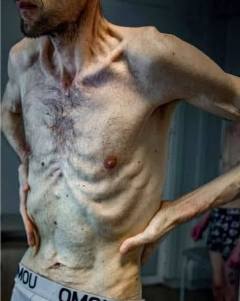 veraizmaylova41's tweet photo. We have known the photographs of prisoners from Dachau, Buchenwald, Auschwitz, and Birkenau since childhood. These photos are from 2026. They show Ukrainian prisoners of war in Russian camps. https://t.co/uz28q08Whm