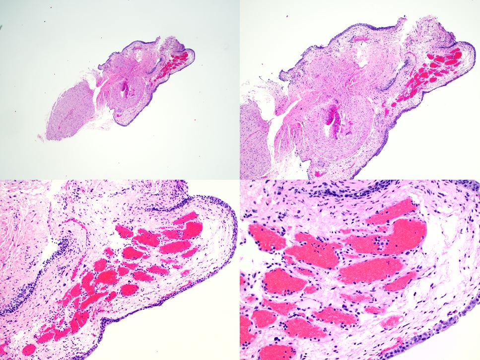pathothama tweet picture