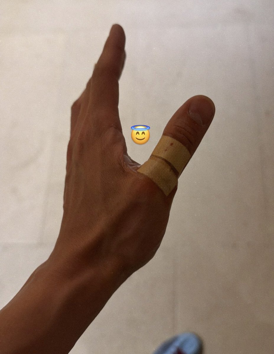 W00LOOKS's tweet photo. NOT WOOYOUNG GETTING SCRATCHED TRYING TO PAT A KITTY 😭😭😭😭😭 https://t.co/PePssCchgV