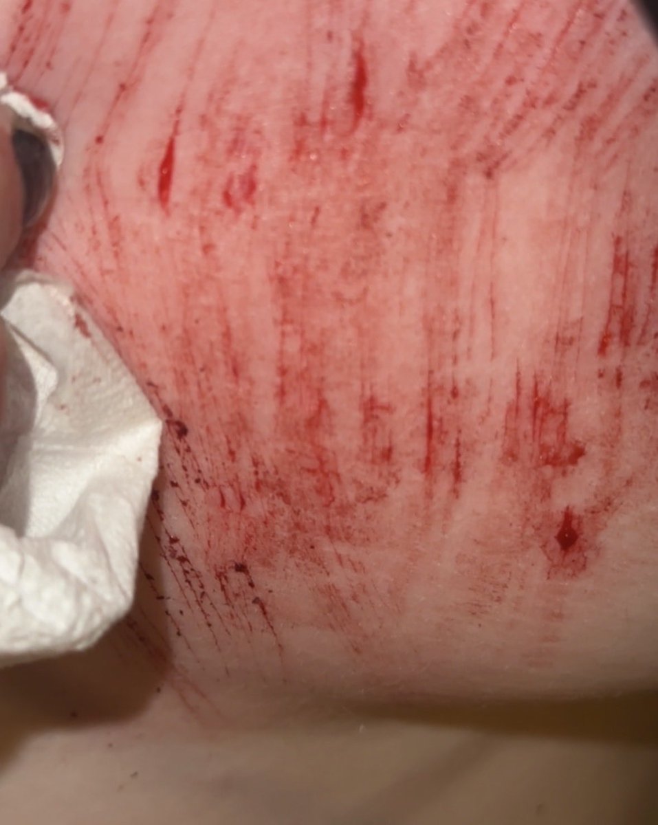 lxnatc's tweet photo. some more sfx makeup from last night #shtwt https://t.co/1Ydoq8pzHC