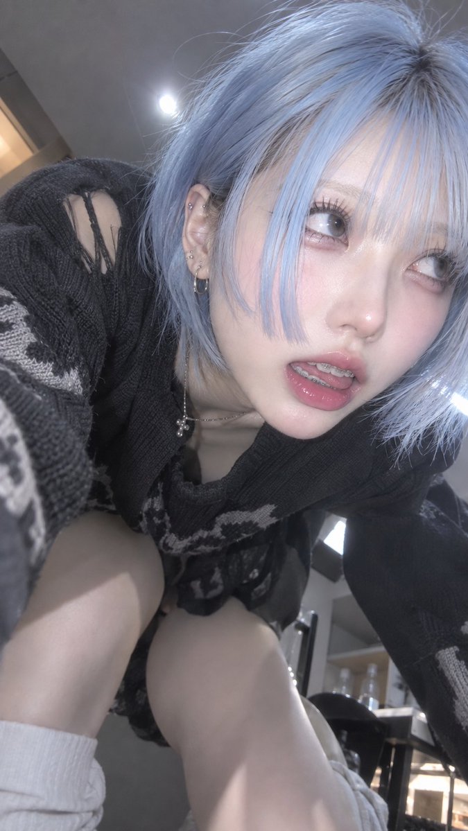 hinakelos's tweet photo. ワイヤー矯正かわいくないですか https://t.co/9qszt2xgdK
