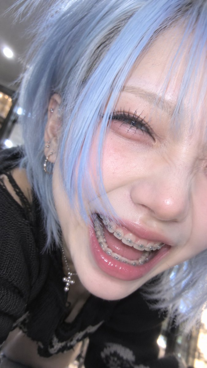 hinakelos's tweet photo. ワイヤー矯正かわいくないですか https://t.co/9qszt2xgdK