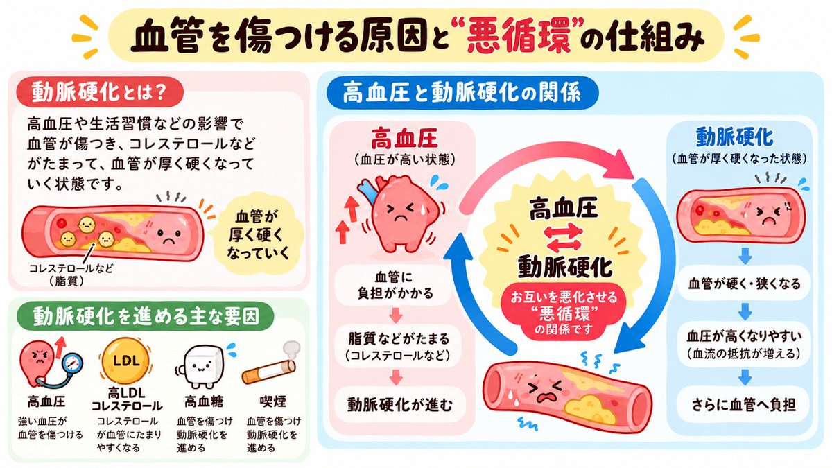 ouchi_training_'s tweet photo. 動脈硬化と血圧の関係🌿

▼動脈硬化とは
・高血圧などで血管の壁に負担がかかる
・コレステロールなどが血管の壁にたまる
・血管の壁が厚く硬くなっていく

▼血圧との関係
・血管が硬くなり広がりにくくなる
・血液が流れたときの圧力が高まりやすい
・高血圧がさらに血管へ負担をかける

高血圧と動脈硬化は、
お互いに影響し合う“悪循環”の関係です💦