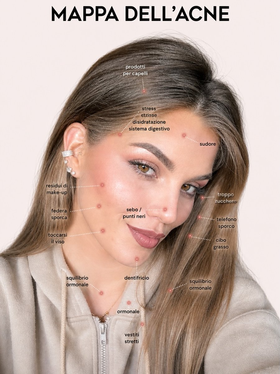GayleneRaiche's tweet photo. L’acne non ha una sola causa e non si risolve copiando routine o prodotti virali. Può dipendere da ormoni, infiammazione, skincare inadeguata, occlusione, stress o alimentazione. Capire la tua pelle è il primo passo. https://t.co/l3tujSMJDk