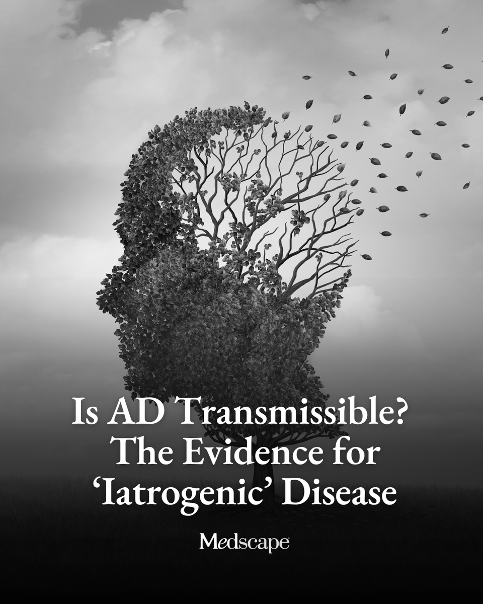 Medscape's tweet photo. Alzheimer’s disease (AD) is not contagious. It cannot be caught through touching, caring for, living with, or otherwise having routine contact with someone who has the disease.

But a small and growing body of evidence suggests that, in rare circumstances, amyloid-beta pathology associated with AD — and possibly AD itself — may be transmitted from one person to another through certain medical procedures including childhood injections of cadaver-derived growth hormone (c-hGH), dura mater grafts, and reused neurosurgical instruments.

What evidence supports the existence of iatrogenic AD, what remains speculative, and how should clinicians discuss the findings with concerned patients? Tap the link to read more: https://t.co/UsTrjsdEoB