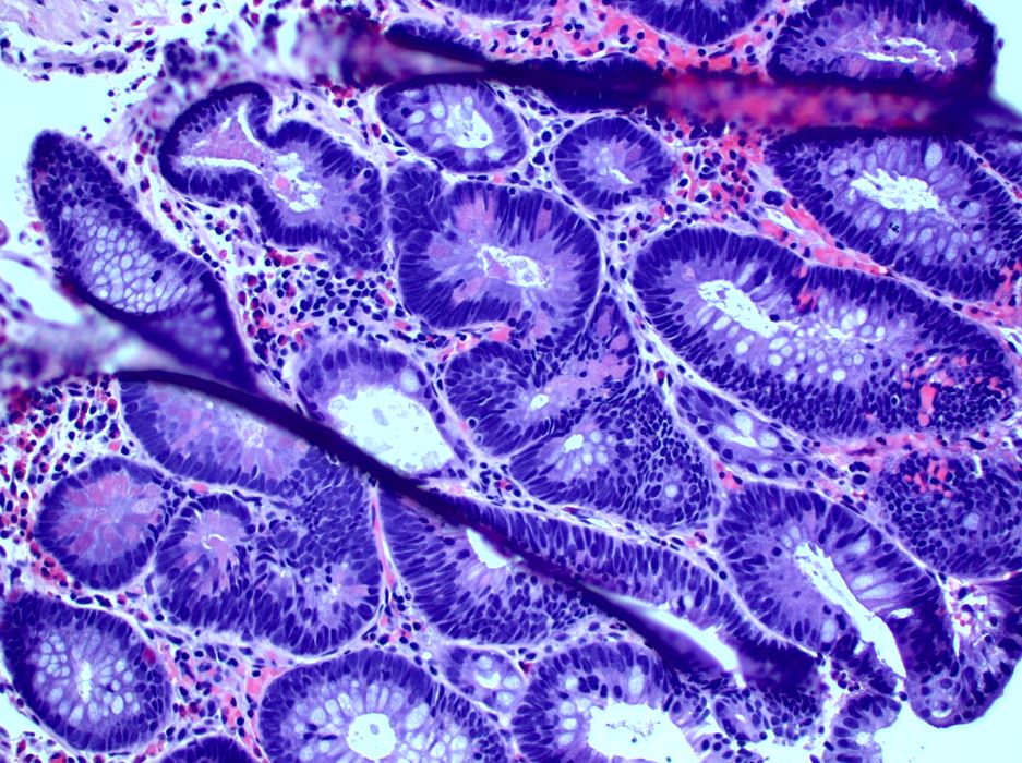 pathothama tweet picture