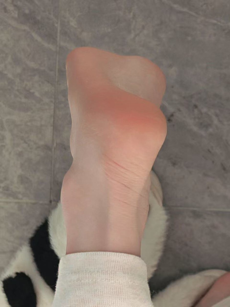 LightBurro7f5r's tweet photo. 今年天气凉的有点快晚上15度，感觉妈妈脚后跟都有点掉皮了，是时候找贱狗的口水来润滑。 https://t.co/egeGabGSMs