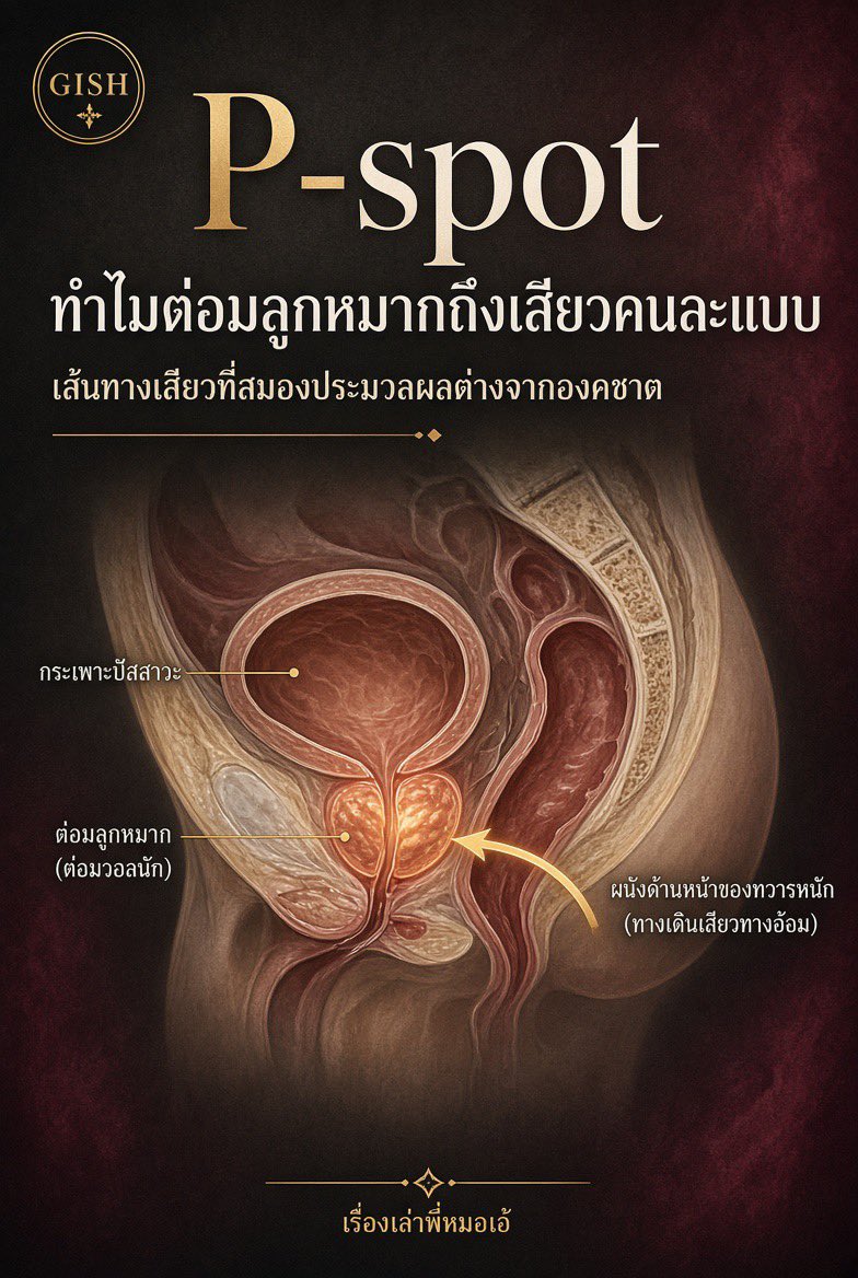 doctoraestory's tweet photo. ทำไมการกระตุ้นต่อมลูกหมาก (P-spot) ถึงทำให้เสียวคนละแบบกับการกระตุ้นองคชาต?

📍หลายคนคิดว่าจุดสุดยอดมีทางเดียว คือทางองคชาต แต่ในทางกายวิภาคและประสาทวิทยา ร่างกายผู้มีต่อมลูกหมากมี “เส้นทางเสียว” อีกเส้นหนึ่งที่ต่างกันชัดเจนครับ

ต่อมล��กหมากอยู่ด้านหน้าของผนังลำไส้ตรง ส่วนที่เรียกกันว่า P-spot เมื่อกดหรือนวดผ่านผนังทวาร จะไปกระตุ้น ….
• ตัวรับความรู้สึกในเยื่อหุ้มต่อมลูกหมาก • เส้นประสาทกลุ่ม prostatic plexus 
• กระเปาะน้ำอสุจิที่อยู่ติดกัน เส้นทางนี้ขึ้นไขสันหลังคนละระดับกับการกระตุ้นองคชาต (เส้น viscera จาก L1–L2 มากกว่า S2–S4 อย่างเดียว) สมองจึงประมวลผลเป็นความรู้สึกที่ “ลึกกว่า แผ่กว้างกว่า และค้างนานกว่า” ไม่ใช่แค่เสียวปลายแล้วจบ

งานสำรวจและรายงานทางคลินิกพบว่า ผู้ที่ฝึกจนคุ้นกับความรู้สึกนี้ มักบรรยายว่า – เสียวทั้งตัว ไม่ใช่แค่จุดเดียว – บางครั้งถึงจุดสุดยอดได้โดยองคชาตไม่แข็งเต็มที่ – หลังเสร็จไม่มียุบทันทีแบบหลังหลั่งปกติ เพราะกลไกไม่ผูกกับ reflex การหลั่งแบบเดิมทั้งหมด

ข้อสำคัญในทางเวชศาสตร์ทาง���พศ: การเสียวจากจุดนี้ ไม่ใช่ปุ่มวิเศษที่ทุกคนกดแล้วเสร็จทันที ต้องผ่อนคลาย ใช้เวลา และเรียนรู้ร่างกายตัวเอง บางคนรู้สึกดีตั้งแต่ครั้งแรก บางคนต้องฝึกหลายครั้ง สมองต้อง “เรียนรู้” เส้นทางใหม่นี้ก่อน

✅สบายใจได้เพราะไม่มีหลักฐานว่าการกระตุ้นต่อมลูกหมากอย่างถูกว���ธีจะทำลายต่อมลูกหมาก ตรงกันข้าม การหลั่งหรือการขับของเหลวจากต่อมเป็นระยะ ยังถูกพูดถึงในบริบทสุขภาพต่อมลูกหมากด้วยซ้ำ

สรุปสั้น ๆ: ร่างกายไม่ได้มีทางเสียวทางเดียว การรู้กายวิภาคช่วยให้เลือกวิธีเสียวได้มากขึ้น ไม่ใช่แค่เร็วขึ้น 🟣

🥹ใครไม่เคย….ลองดูนะครับ 

#พี่หมอเอ้ #เรื่องเล่าพี่หมอเอ้ #เวชศาสตร์ทางเพศ #ความรู้เรื่องเพศ #Pspot #ต่อมลูกหมาก #เพศศึกษา #GISH #sexeducation #SexualMedicine