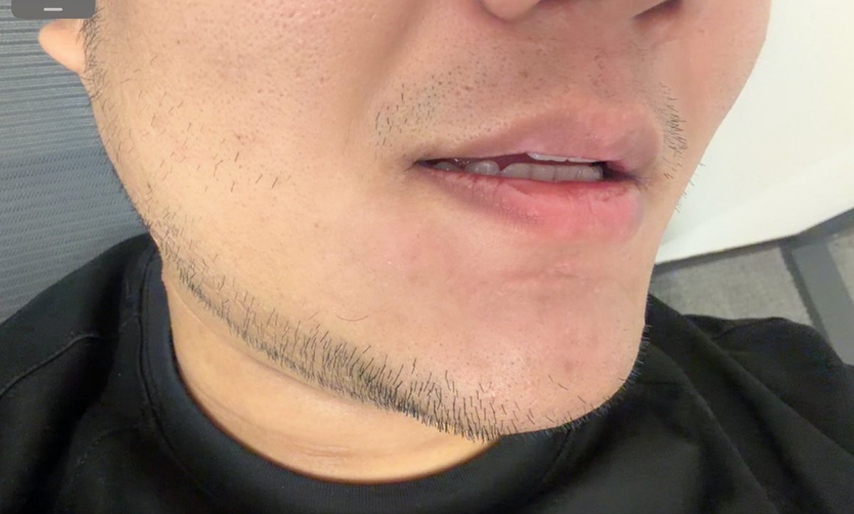 Eddy_XY_'s tweet photo. 已经不注意形象了，在想要不要往某个群体发展了。哈哈哈哈 #络腮胡熊 https://t.co/yTi8KGwSSZ