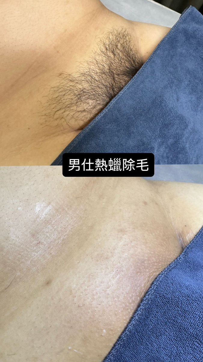 Zhen1103_'s tweet photo. 男仕除毛 官方賴預約👇🏻 
https://t.co/4eXFgjDjSs

#屏東 #內埔 #屏科大 #美和 https://t.co/NoK1KjhxjP