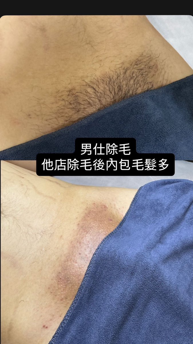 Zhen1103_'s tweet photo. 男仕除毛 官方賴預約👇🏻 
https://t.co/4eXFgjDjSs

#屏東 #內埔 #屏科大 #美和 https://t.co/NoK1KjhxjP